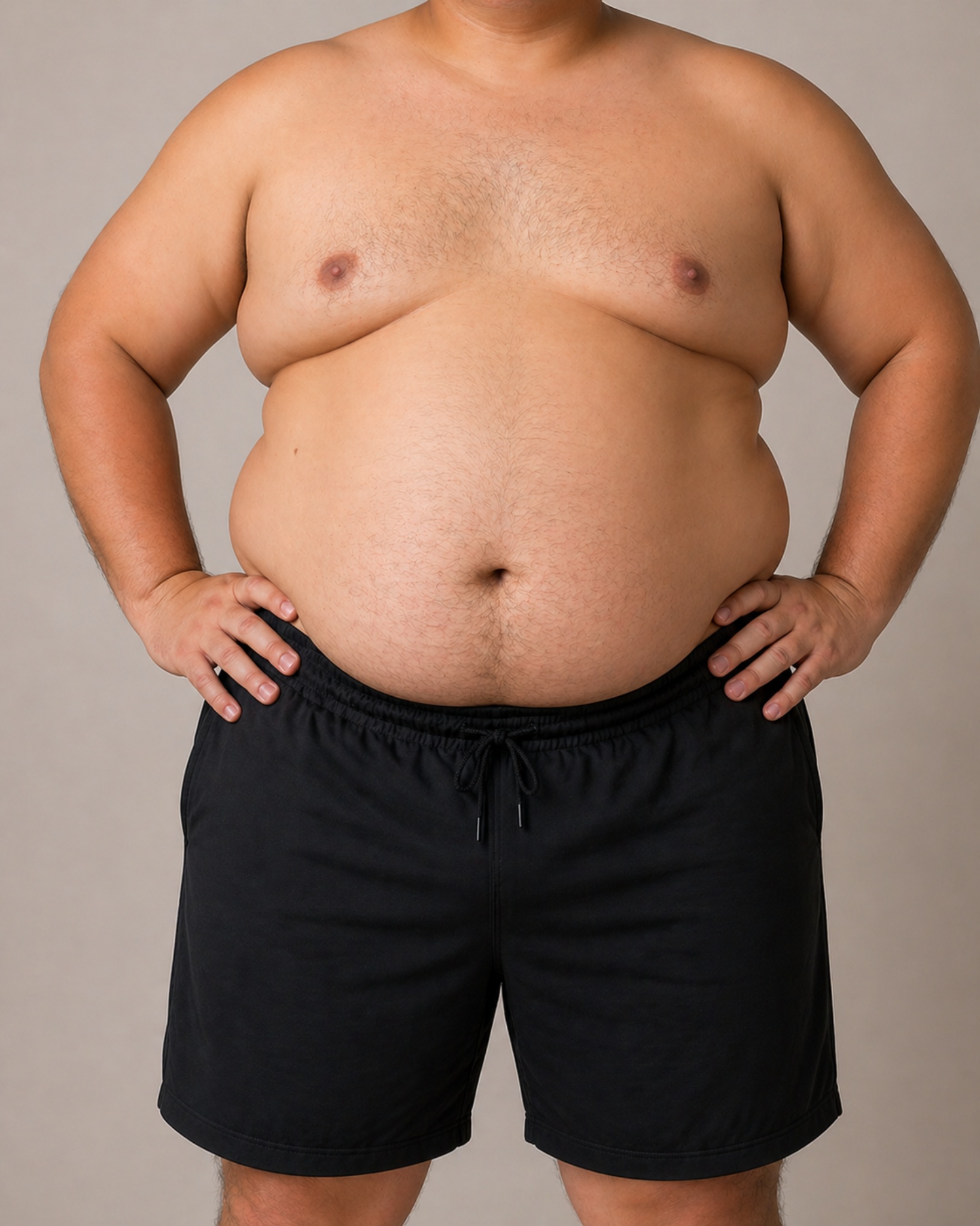 Obesidade