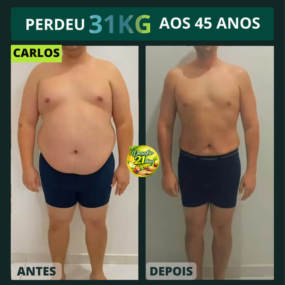 Antes e Depois 3